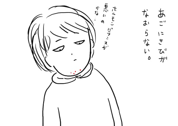 ニキビ