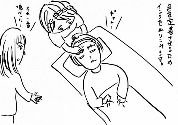 施術7